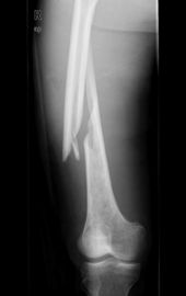 Konida Laser X Ray Tıbbi Görüntüleme