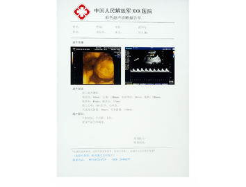 KND-DRYTEC-3000, KND-DRYTEC-4000 için çizilmeye dayanıklı X-ışını Kağıt Tıbbi Film